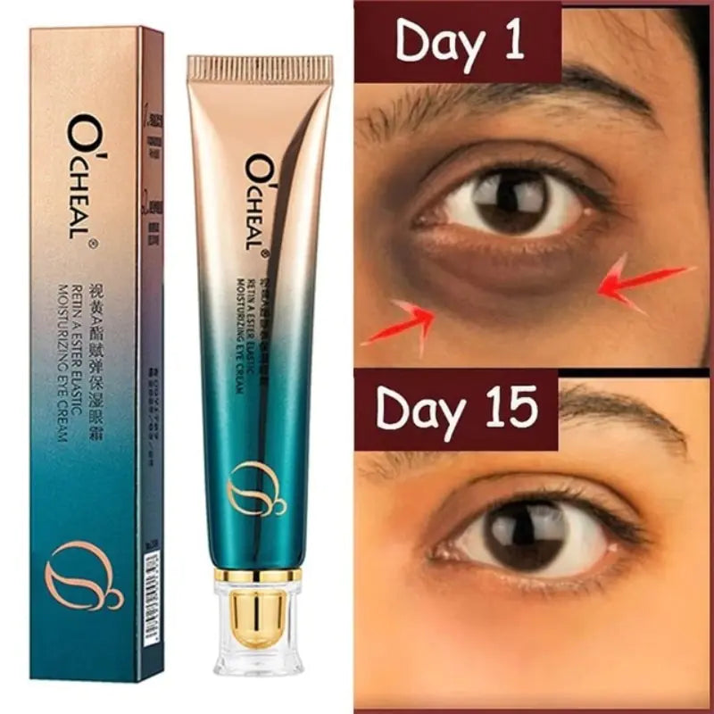 Beyond Skyyn™ Anti-Wrinkle Eye Cream