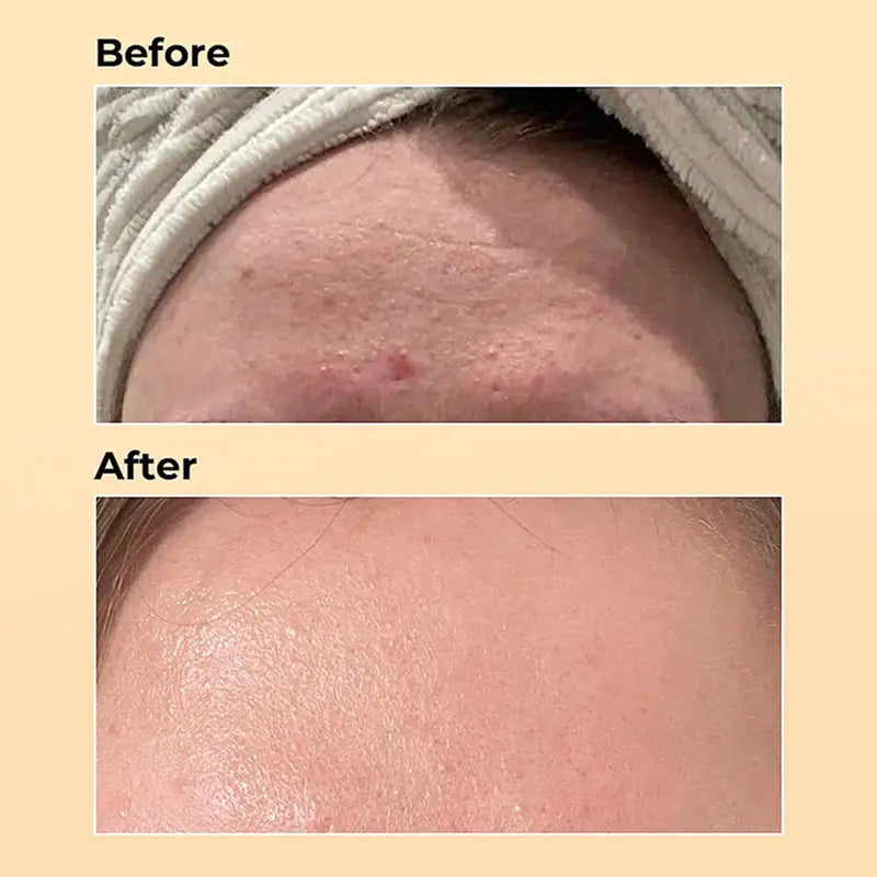 Beyond Skyyn™ Anti-aging Serum