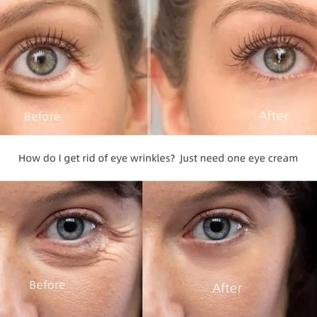 Beyond Skyyn™ Anti-Wrinkle Eye Cream